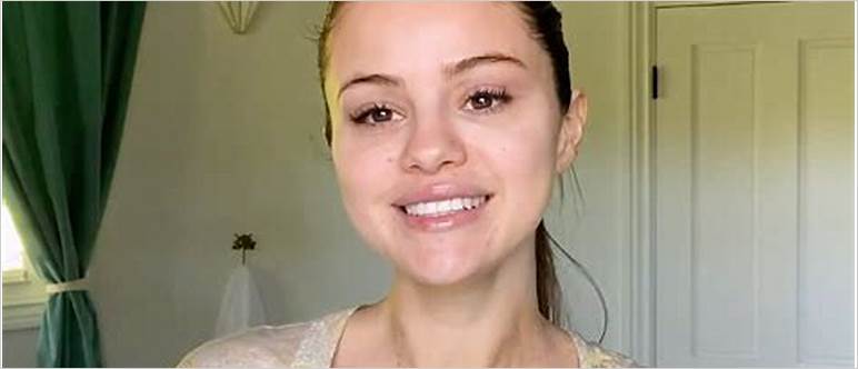 Selena gomez face swollen